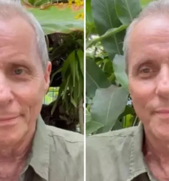 Marido de Malu Mader Tony Bellotto revela luta contra cancer