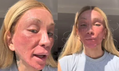 Maya Massafera aparece com rosto alterado por peeling facial.webp