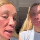 Maya Massafera aparece com rosto alterado por peeling facial.webp