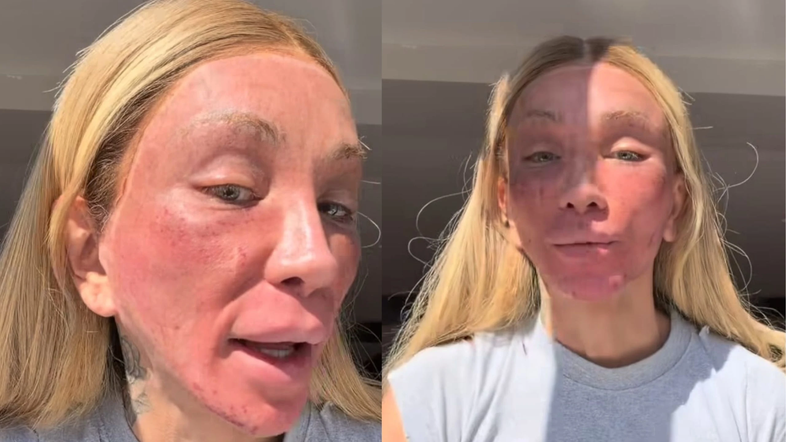 Maya Massafera aparece com rosto alterado por peeling facial.webp