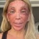 Maya Massafera explica aparencia com rosto machucado apos procedimento video
