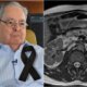 Morre Benedito Ruy Barbosa e causa da morte e revelada