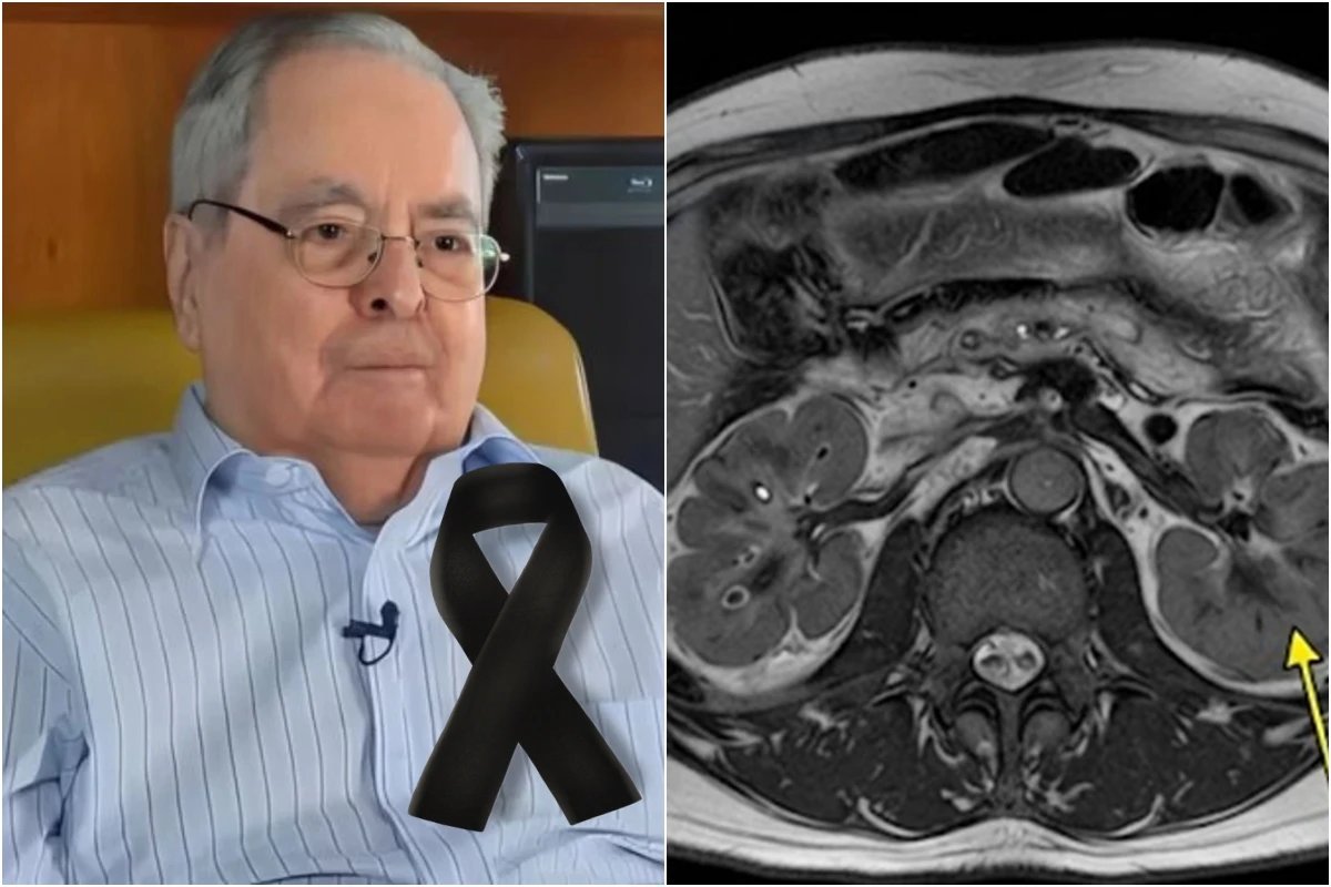 Morre Benedito Ruy Barbosa e causa da morte e revelada