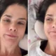 SUSTO Samara Felippo aparece acamada e cheia de curativos.webp