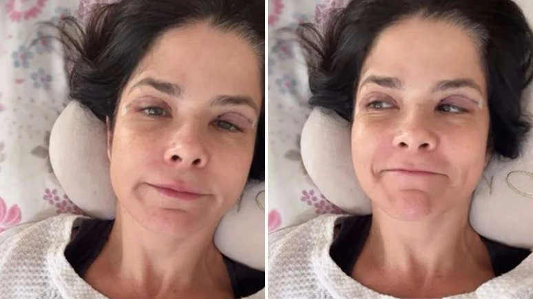 SUSTO Samara Felippo aparece acamada e cheia de curativos.webp