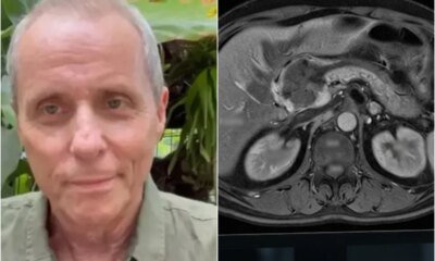 Tony Bellotto abre mao de lutar contra o cancer de