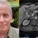 Tony Bellotto abre mao de lutar contra o cancer de