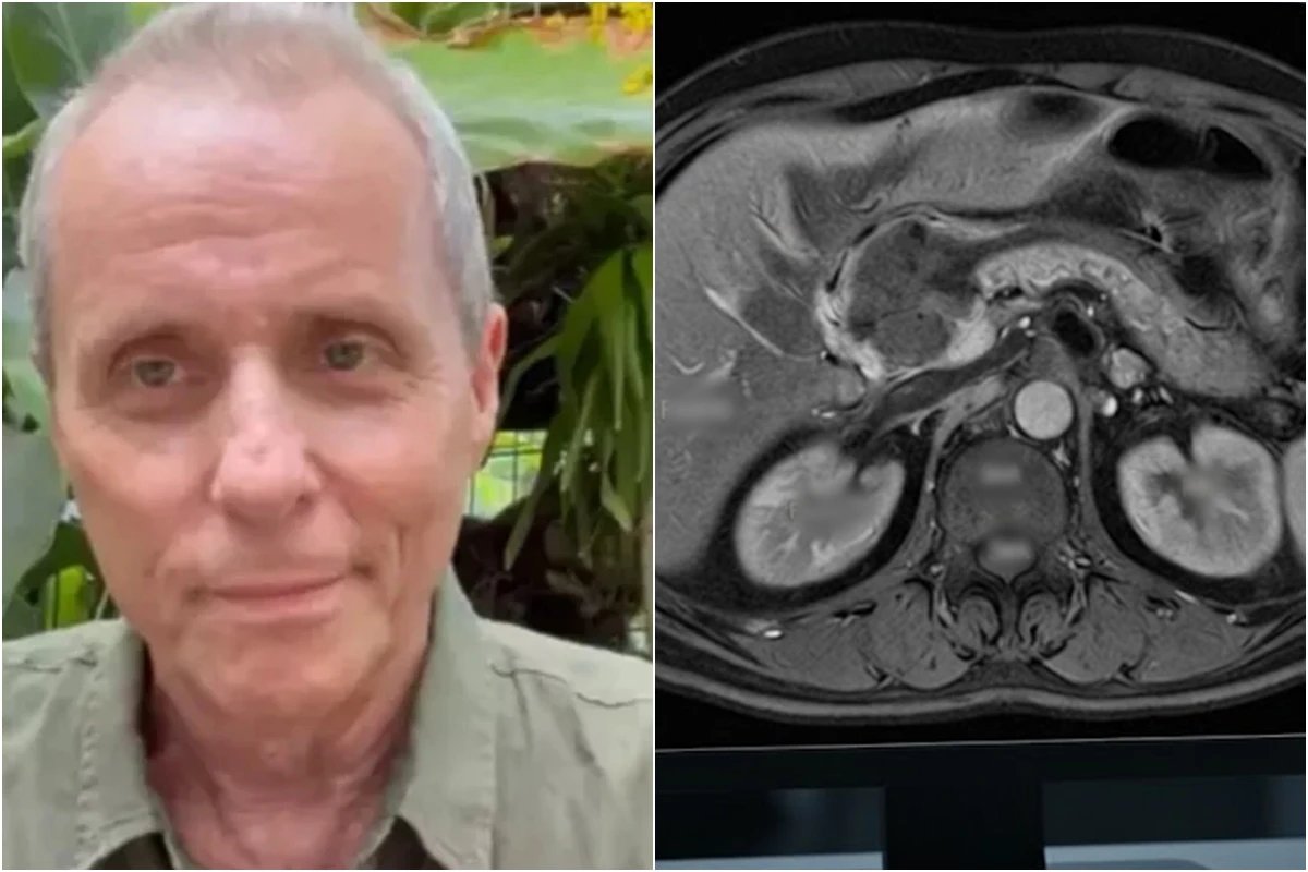 Tony Bellotto abre mao de lutar contra o cancer de