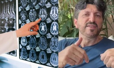 A verdade sobre o diagnostico de Lito Sousa e a