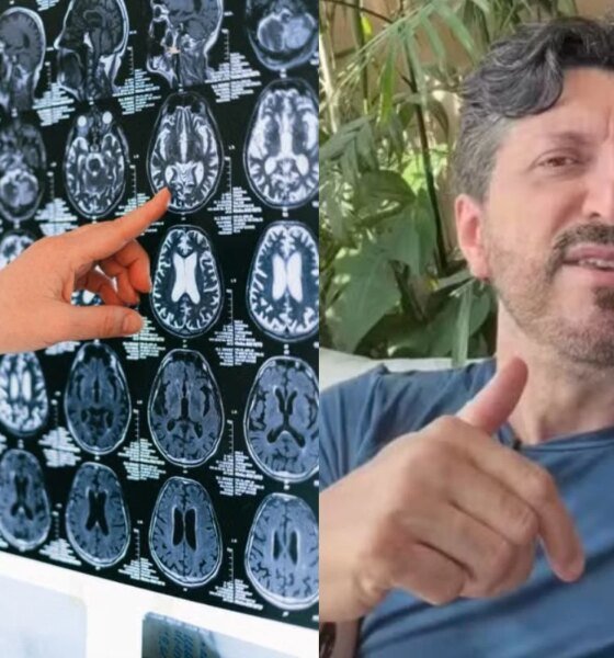 A verdade sobre o diagnostico de Lito Sousa e a