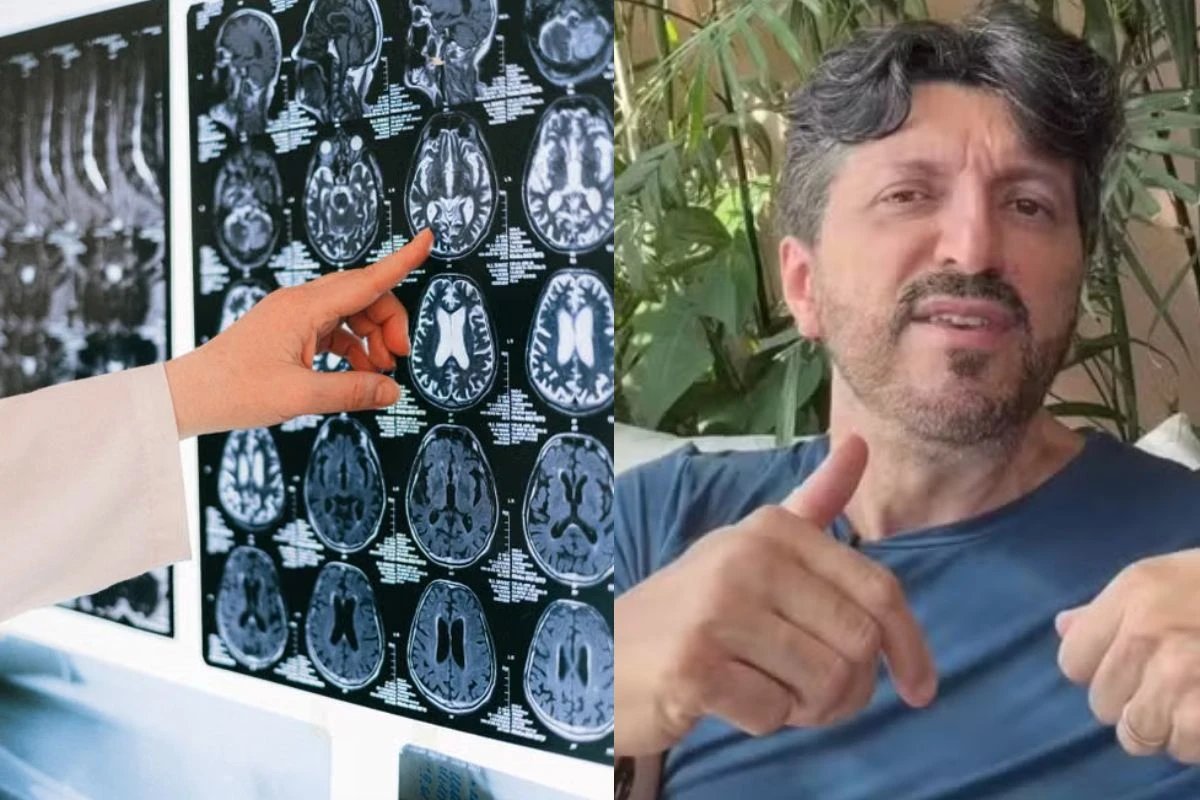 A verdade sobre o diagnostico de Lito Sousa e a