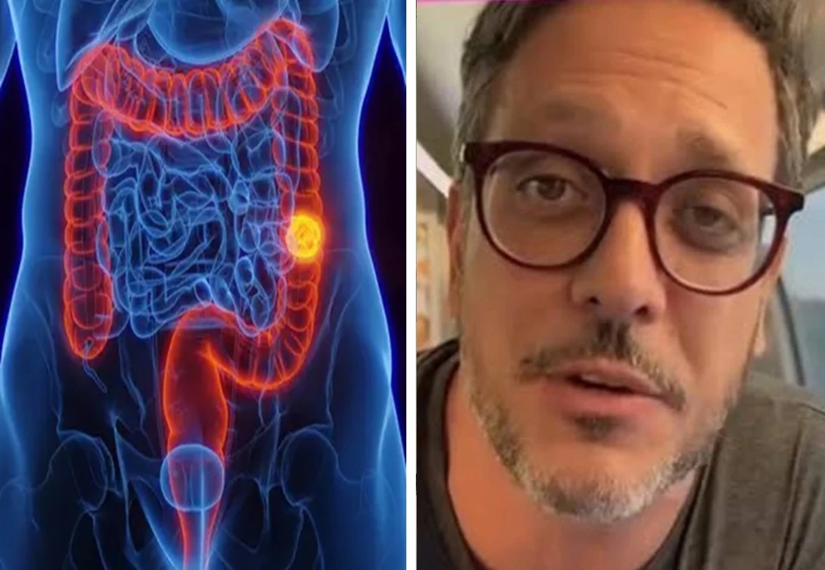 Aos 52 anos Lucio Mauro Filho revela diagnostico de.webp