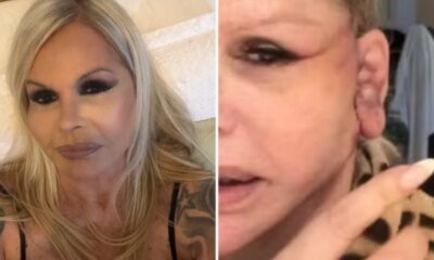 Apos cirurgia plastica Monique Evans fica em choque com o