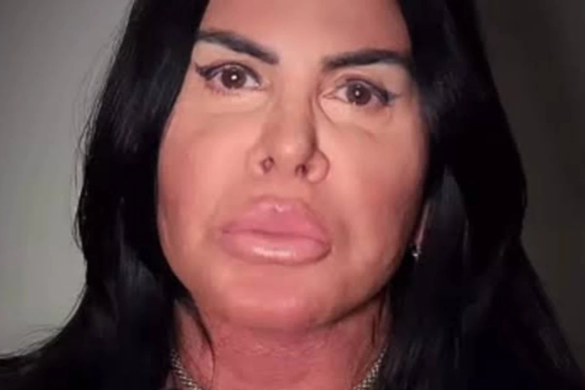 Apos transplante chega noticia sobre Gretchen aos 67 anos