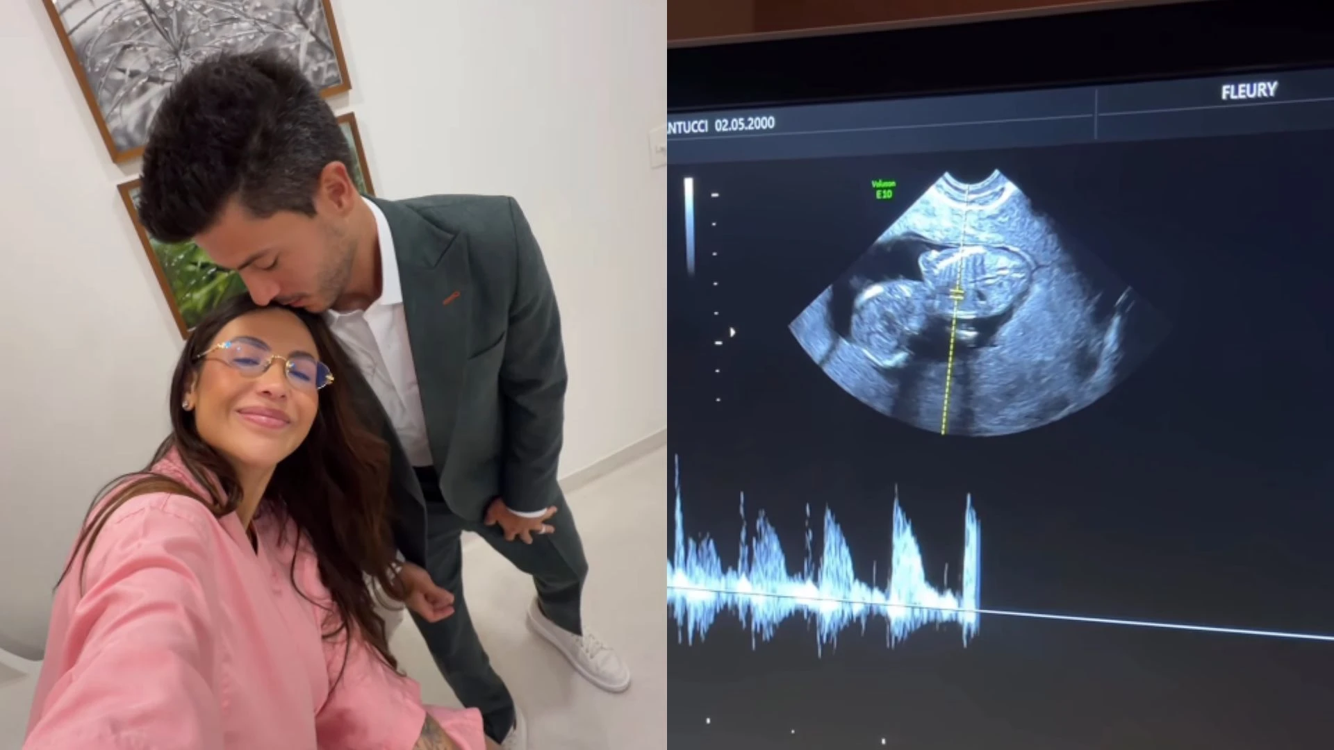Arthur Aguiar e Jheny Santucci anunciam segunda gravidez Uma.webp