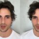 Diagnostico e revelado e Fiuk faz desabafo sobre sua real