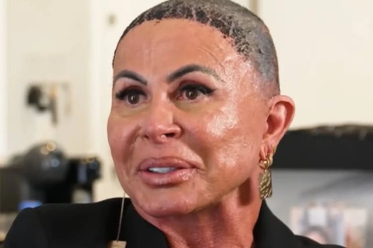 Doenca e confirmada e Gretchen faz anuncio sobre sua real