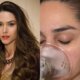 Escondendo real estado de saude Fernanda Machado passou por cirurgias