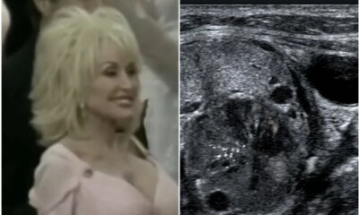Esta foi a causa da morte da cantora Dolly Parton