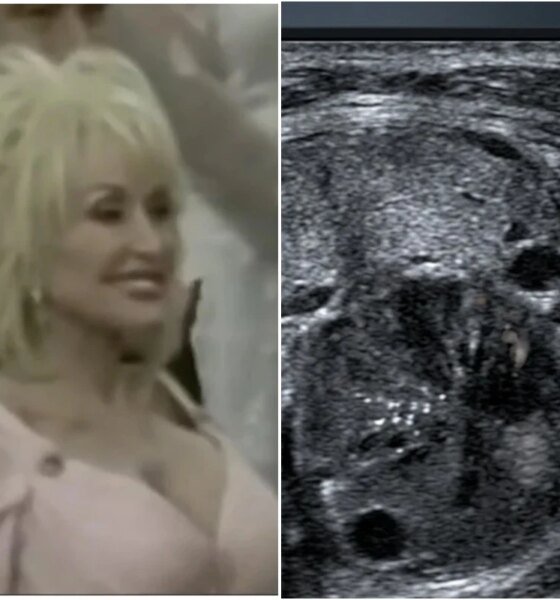 Esta foi a causa da morte da cantora Dolly Parton