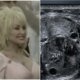 Esta foi a causa da morte da cantora Dolly Parton