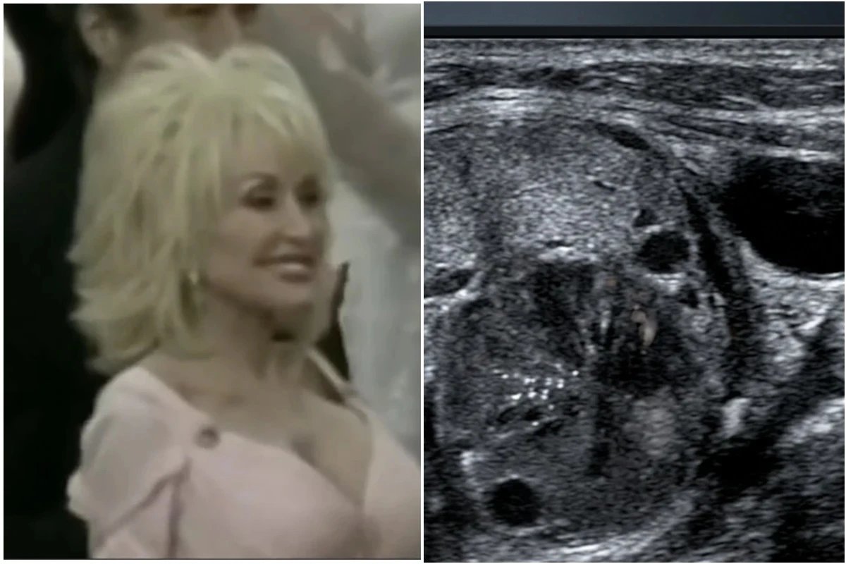 Esta foi a causa da morte da cantora Dolly Parton