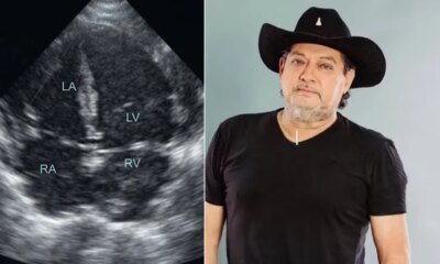 Esta foi a causa da morte do cantor sertanejo Lucas