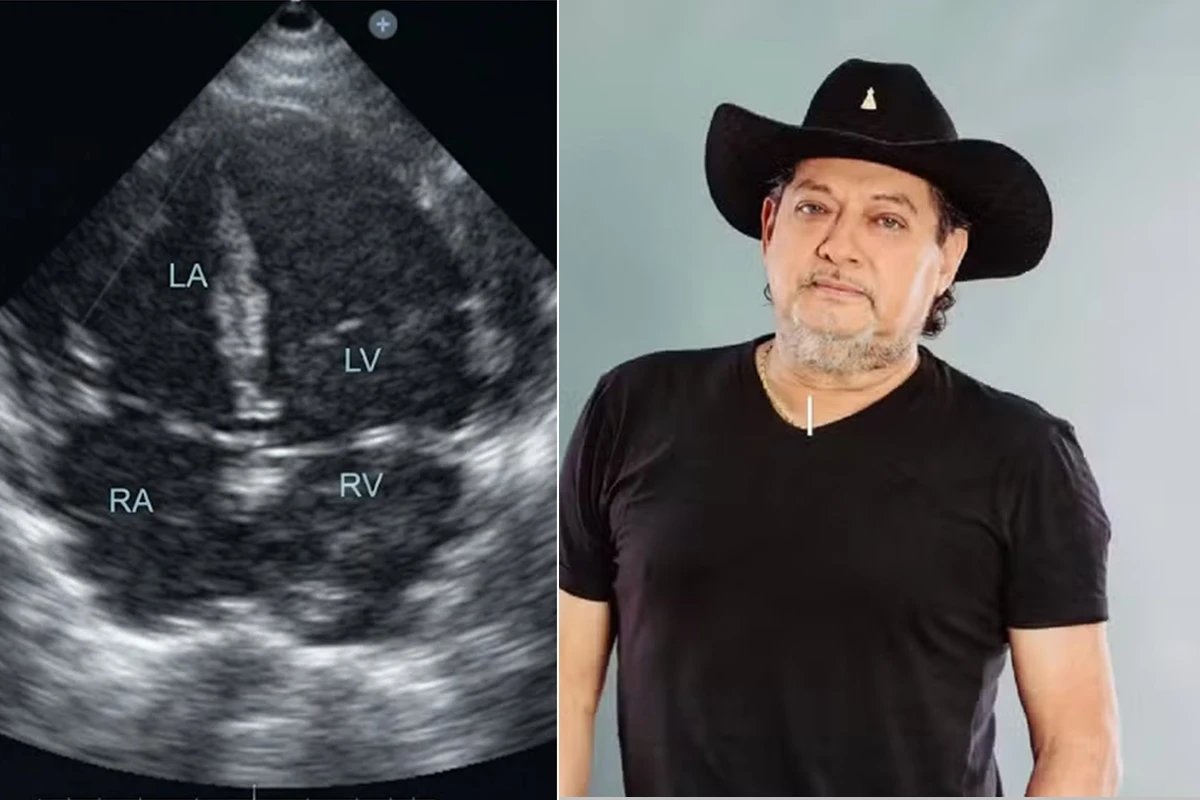 Esta foi a causa da morte do cantor sertanejo Lucas