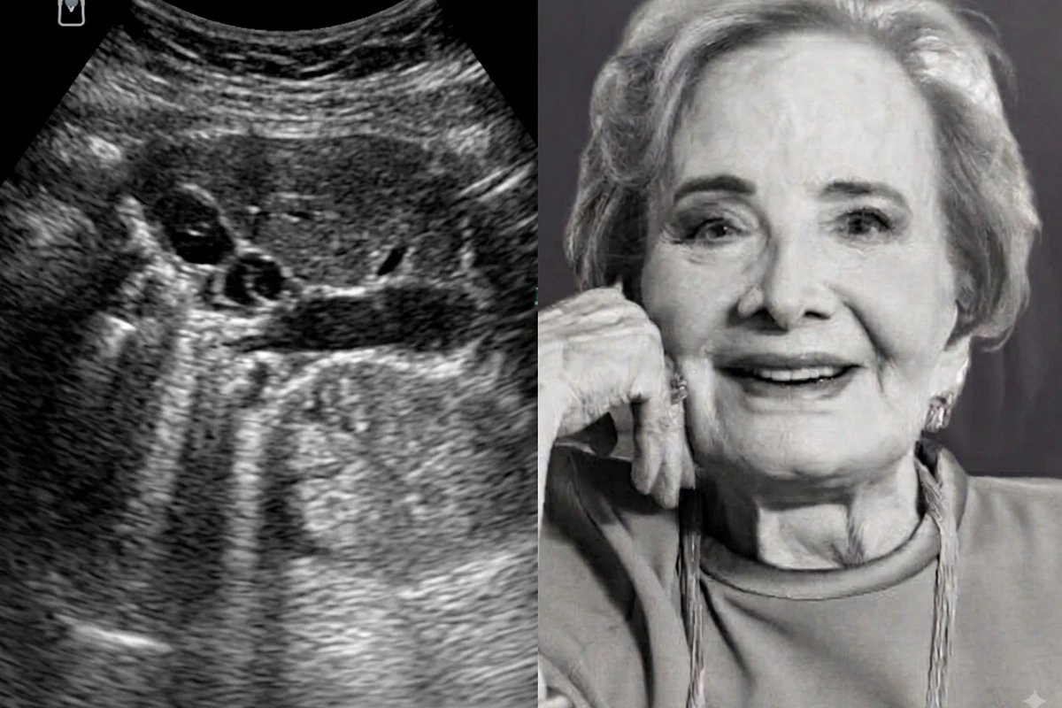 Esta foi a doenca que Gloria Menezes enfrentou antes de