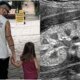 Esta foi a doenca rara diagnosticada na filha do cantor