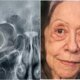 Este e o problema de saude diagnosticado em Fernanda Montenegro