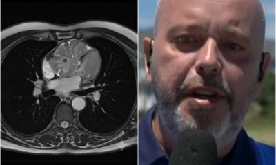 Este e o tumor diagnosticado em Alex Escobar ele passou
