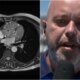 Este e o tumor diagnosticado em Alex Escobar ele passou