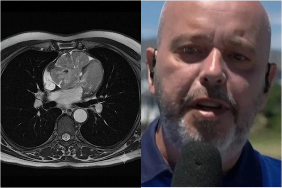 Este e o tumor diagnosticado em Alex Escobar ele passou
