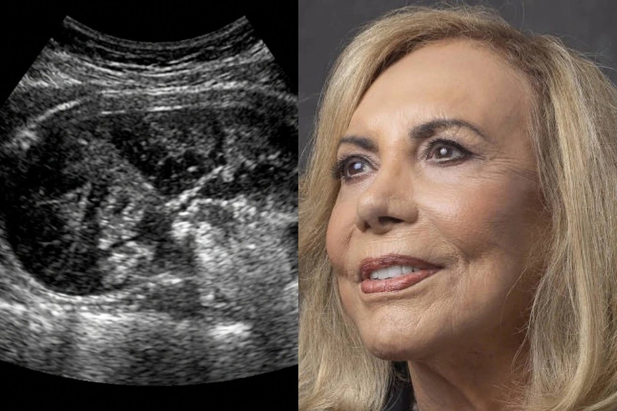 Este foi o diagnostico que Arlete Salles recebeu aos 88