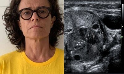 Este foi o tipo de cancer diagnosticado na cantora Zelia