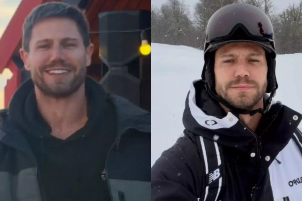 Ex BBB Jonas sofre acidente inesperado durante viagem e revela fratura