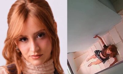Influenciadora sofre acidente grave em casa imagem assusta ‘A vida
