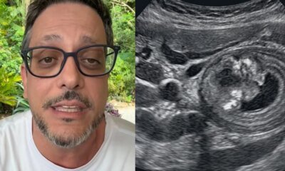Lucio Mauro Filho conta como descobriu cancer e faz alerta