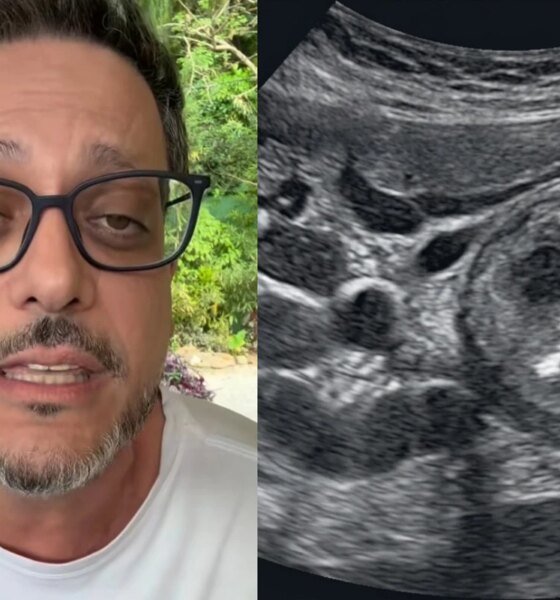 Lucio Mauro Filho conta como descobriu cancer e faz alerta