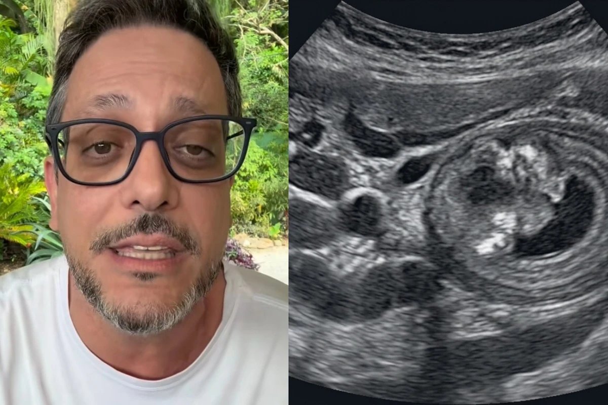 Lucio Mauro Filho conta como descobriu cancer e faz alerta