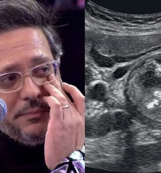 Lucio Mauro Filho descobre cancer de intestino sem apresentar sintomas