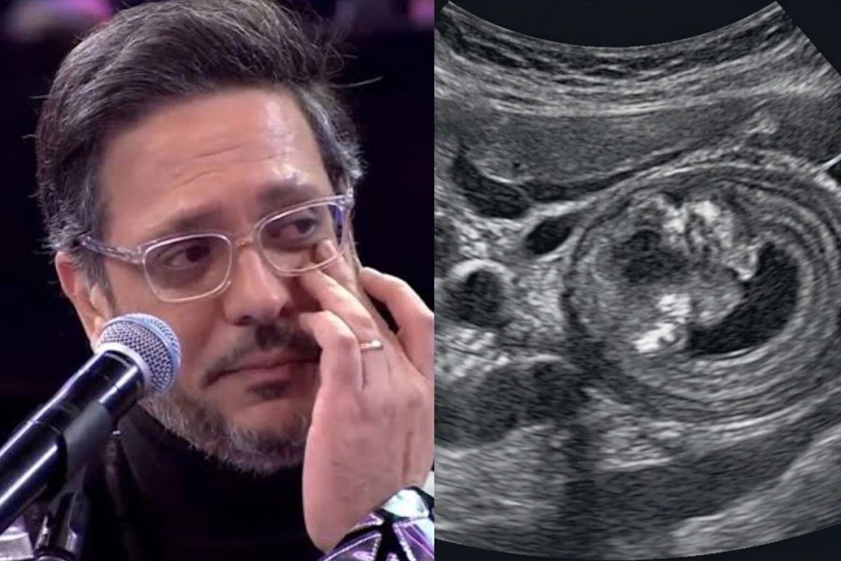 Lucio Mauro Filho descobre cancer de intestino sem apresentar sintomas