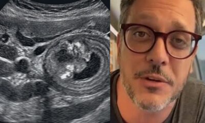 Lucio Mauro Filho revela diagnostico de doenca e desabafa ‘Devastador…