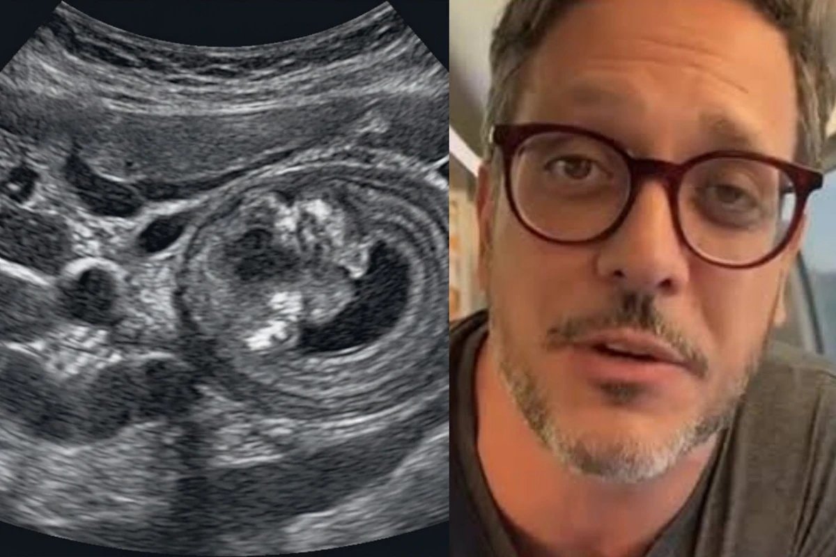 Lucio Mauro Filho revela diagnostico de doenca e desabafa ‘Devastador…