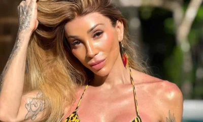 Maya Massafera aparece com rosto avermelhado apos novo procedimento.webp