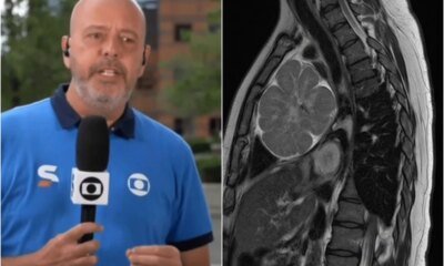 Medicos tomam decisao importante apos descoberta de tumor em Alex