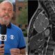 Medicos tomam decisao importante apos descoberta de tumor em Alex