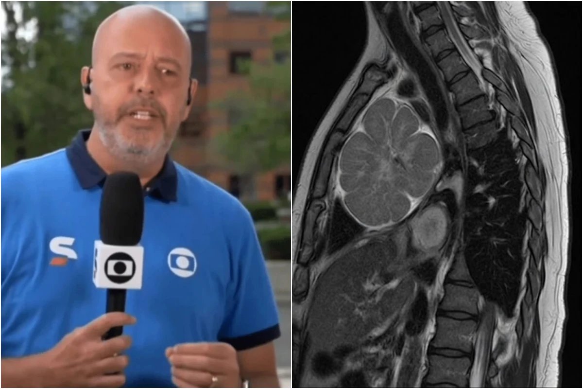 Medicos tomam decisao importante apos descoberta de tumor em
