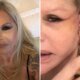 Monique Evans detalha cuidados diarios da esposa apos cirurgia plastica